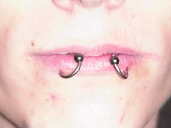 piercing no lábio duplo (42) 