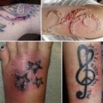Os riscos e benefícios das tatuagens