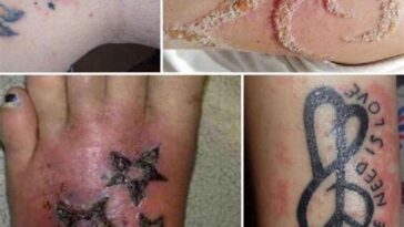 Os riscos e benefícios das tatuagens